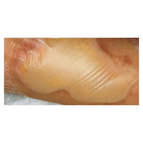 Hydrocoll Classic 7,5 x 7,5cm selbsthaft. AP 10 Hydrokolloid-Verband