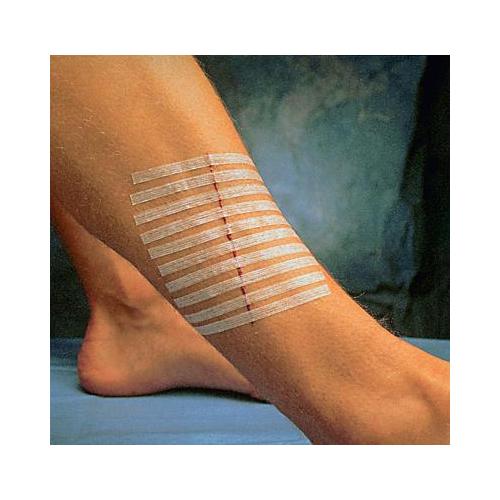 Steri-Strip 3,0 x 75,0 mm AP 50 Umschläge á 5 Streifen