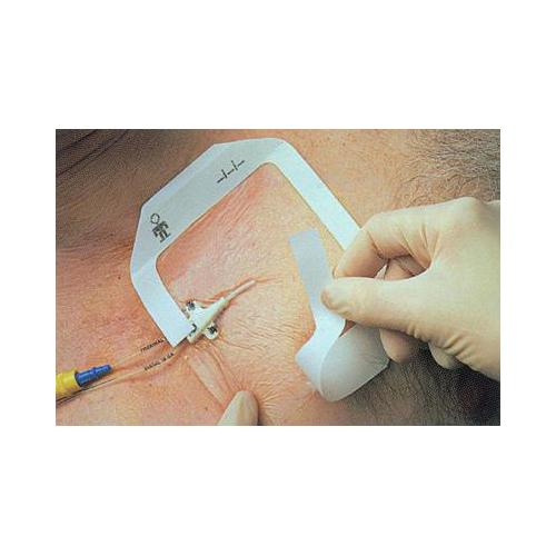 Tegaderm Film ster. Transparentverband AP 50 10,0 x 12,0 cm