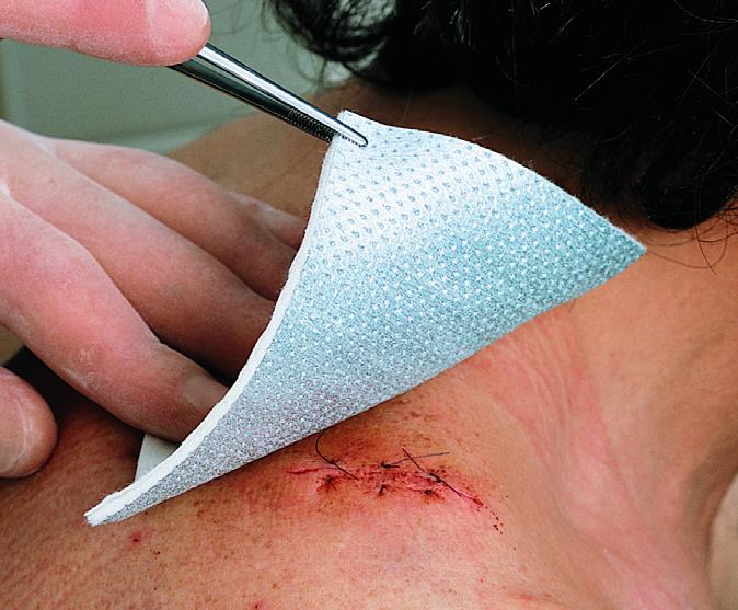 Metalline Kompresse steril, 8x10cm, 50 Stück