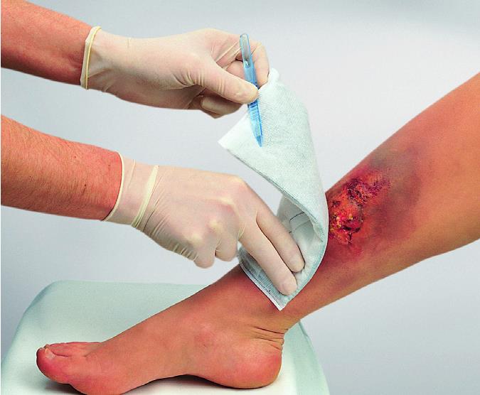 Vliwaktiv Aktivkohle-Saugkompresse steril, 10x10cm, 20 Stück